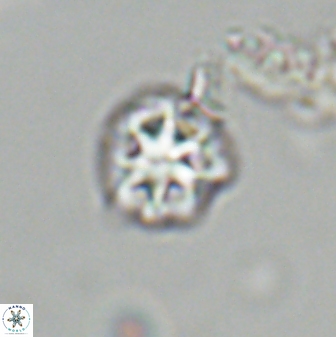 Olladiscoaster bordii 31318