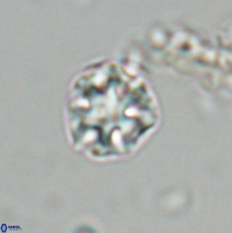 Olladiscoaster bordii 31319