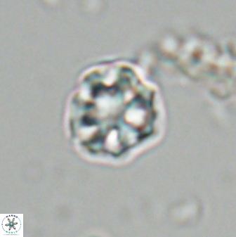 Olladiscoaster bordii 31321