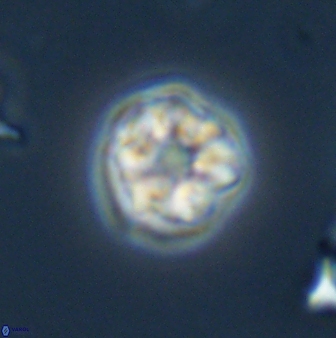Olladiscoaster bordii 31323