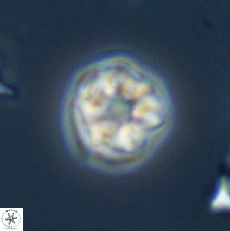 Olladiscoaster bordii 31323