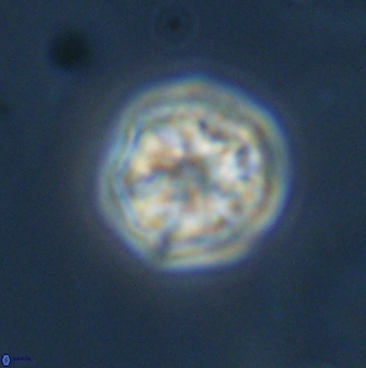 Olladiscoaster bordii 31329