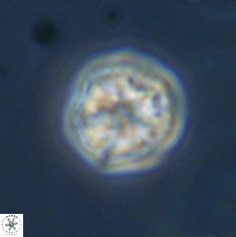 Olladiscoaster bordii 31329