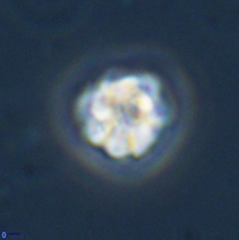 Olladiscoaster bordii 31331