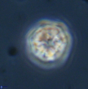 Olladiscoaster bordii 31332