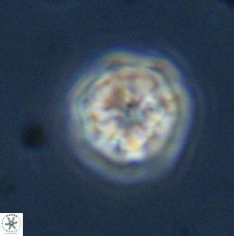 Olladiscoaster bordii 31332