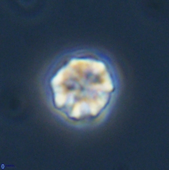 Olladiscoaster bordii 31333