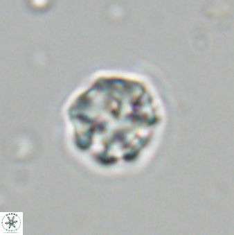 Olladiscoaster bordii 31335