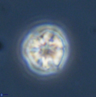 Olladiscoaster bordii 31355