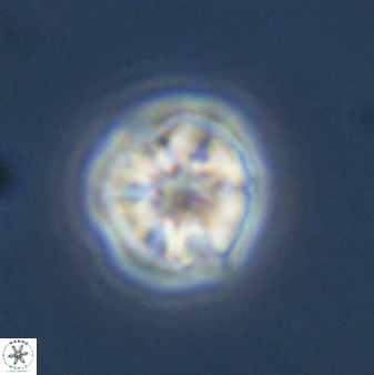 Olladiscoaster bordii 31355