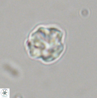 Olladiscoaster bordii 31359