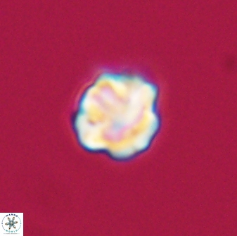 Olladiscoaster bordii 31360