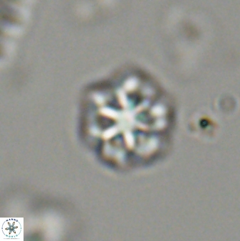Olladiscoaster bordii 32626
