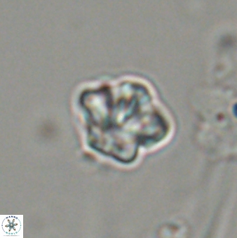 Olladiscoaster bordii 32633