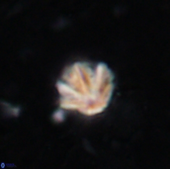 Olladiscoaster catinatus 13477