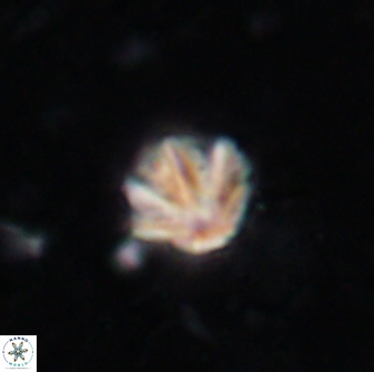 Olladiscoaster catinatus 13477