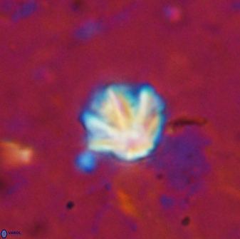 Olladiscoaster catinatus 13478