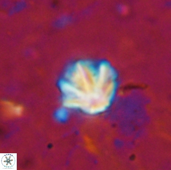 Olladiscoaster catinatus 13478