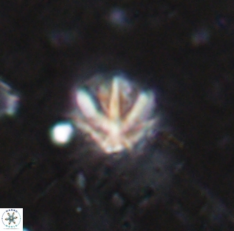Olladiscoaster catinatus 13481