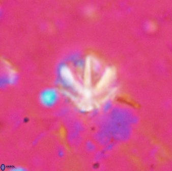 Olladiscoaster catinatus 13482
