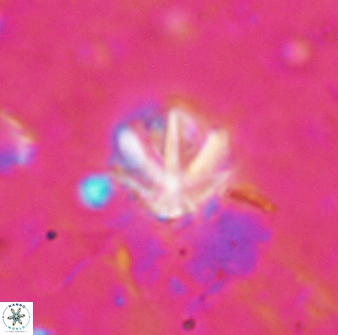 Olladiscoaster catinatus 13482