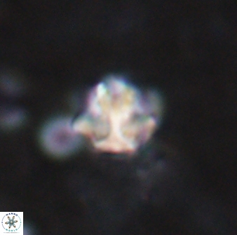 Olladiscoaster catinatus 13484