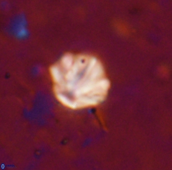 Olladiscoaster catinatus 13487