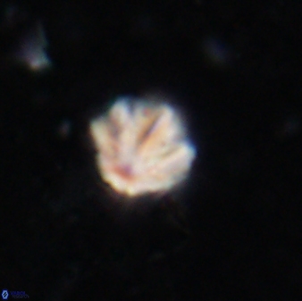 Olladiscoaster catinatus 13488
