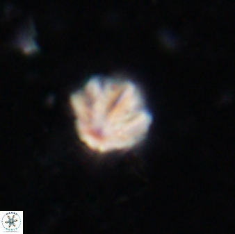 Olladiscoaster catinatus 13488