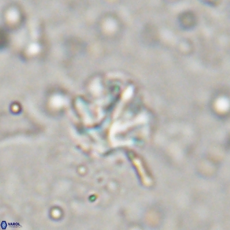 Olladiscoaster catinatus 13489