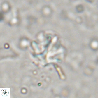 Olladiscoaster catinatus 13489
