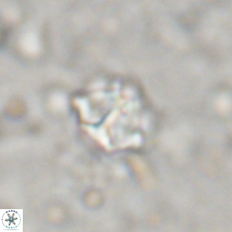 Olladiscoaster catinatus 13490