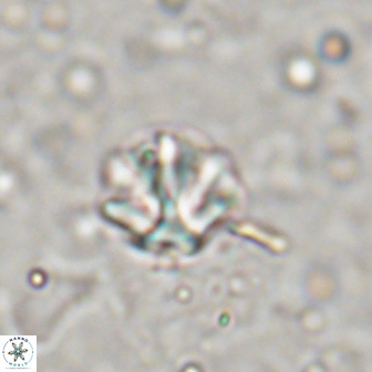 Olladiscoaster catinatus 13492