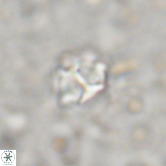 Olladiscoaster catinatus 13493
