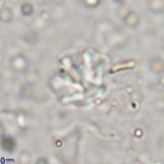 Olladiscoaster catinatus 13494