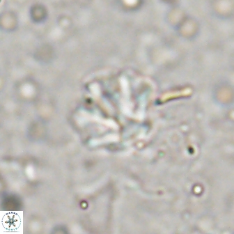 Olladiscoaster catinatus 13494