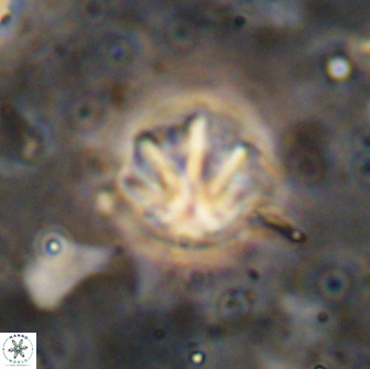 Olladiscoaster catinatus 13495