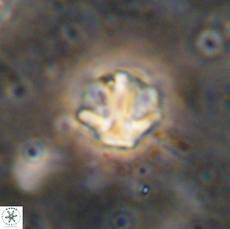 Olladiscoaster catinatus 13496