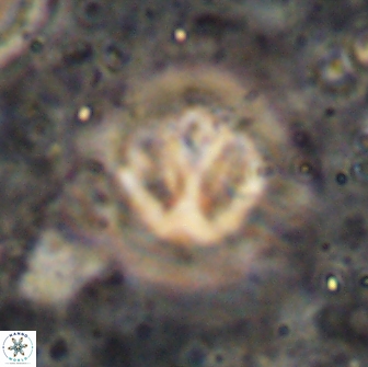 Olladiscoaster catinatus 13497