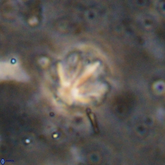 Olladiscoaster catinatus 13499
