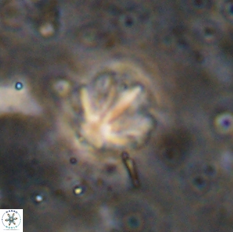 Olladiscoaster catinatus 13499