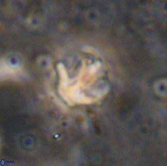 Olladiscoaster catinatus 13500