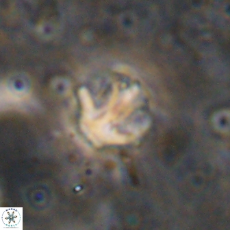 Olladiscoaster catinatus 13500