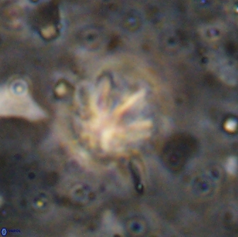 Olladiscoaster catinatus 13501