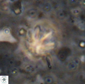 Olladiscoaster catinatus 13501