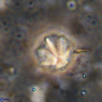 Olladiscoaster catinatus 13503