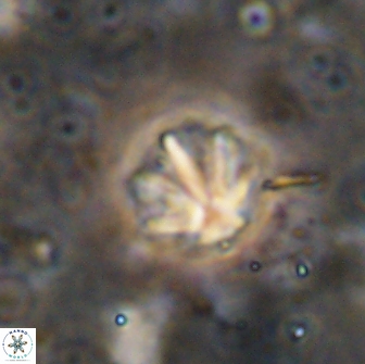 Olladiscoaster catinatus 13503