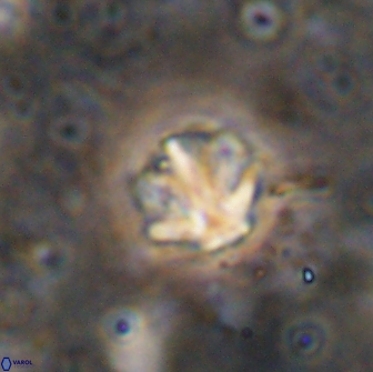 Olladiscoaster catinatus 13504