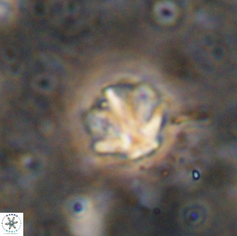 Olladiscoaster catinatus 13504