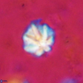 Olladiscoaster catinatus 29623